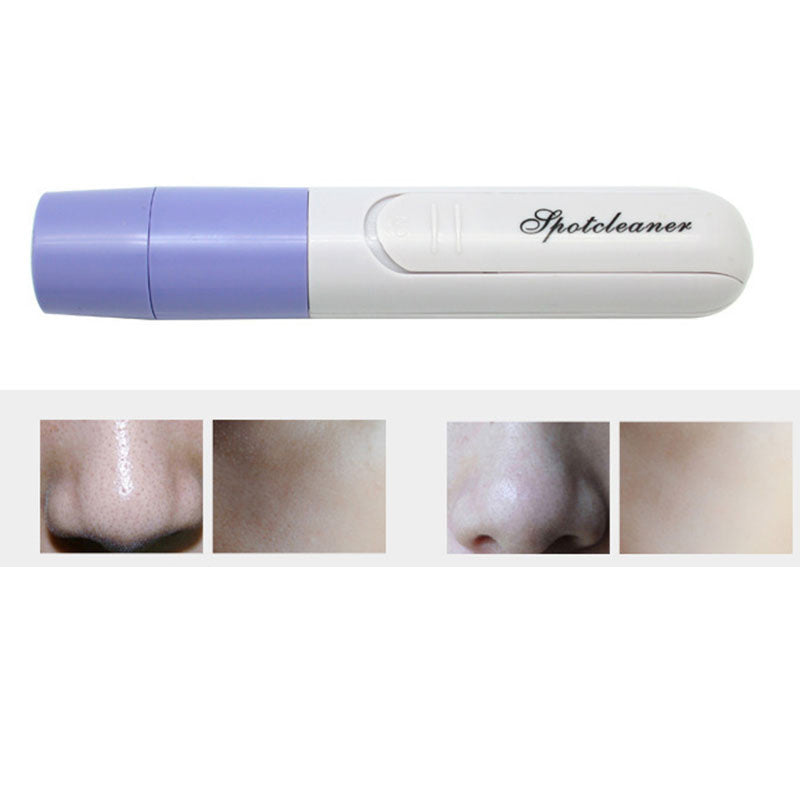 Electric Pore Cleanser Facial Massager BAZONA