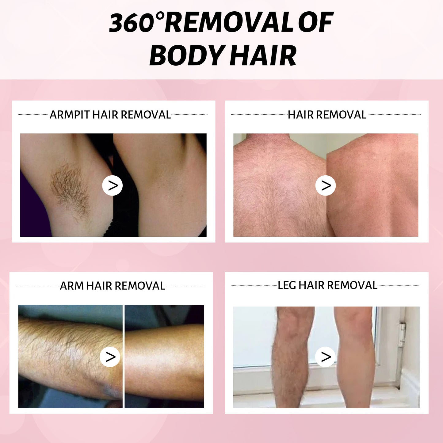 30ml 100ml Hair Removal Spray Depilatory Armpit Hair And Legs Hair Foam Mousse And Removal Is Gentle Hair Cream Spray Non-irritating - bazona.com