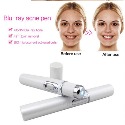 Blue Light Therapy Acne Laser Pen Soft Scar Wrinkle Removal Treatment Device Skin Care Beauty Equipment BAZONA