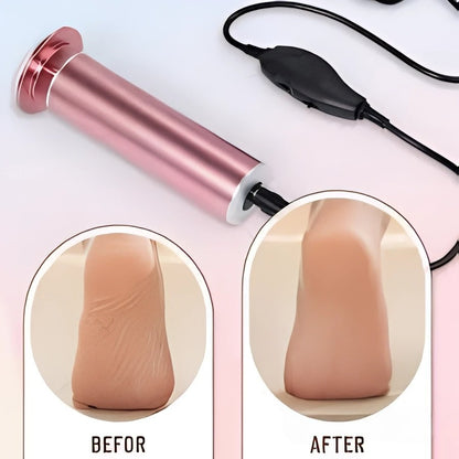 Skin Tag Remover Kit & Callus Remover